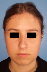 femme de face