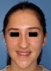 femme de face