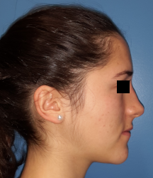 femme de profil
