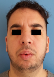 homme de face