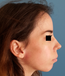 femme de profil