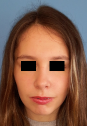 femme de face